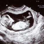 Home pregnancy scan 12 weeks dads